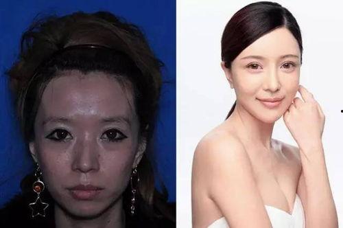 炉石毛毛整容前照片,从素颜到颜值巅峰的蜕变之路